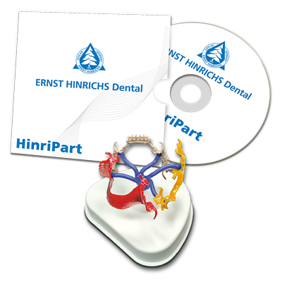 HinriPart CAD - Teleskopmodul